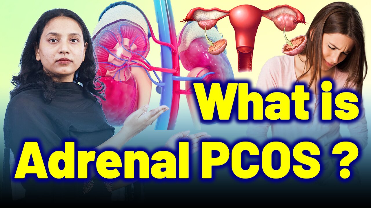 What If Your PCOS Is Actually Adrenal PCOS? | Treatment Cure Medicine Surgery | Gynaecology