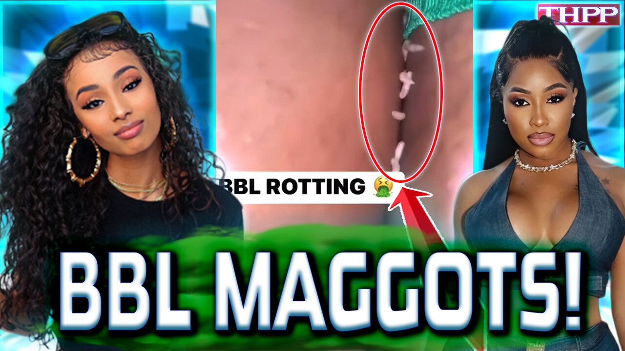 STRUGGLE Rappers BBLs are ROTTING with MAGGOTS!? Corey Holcomb WARNED Yall!