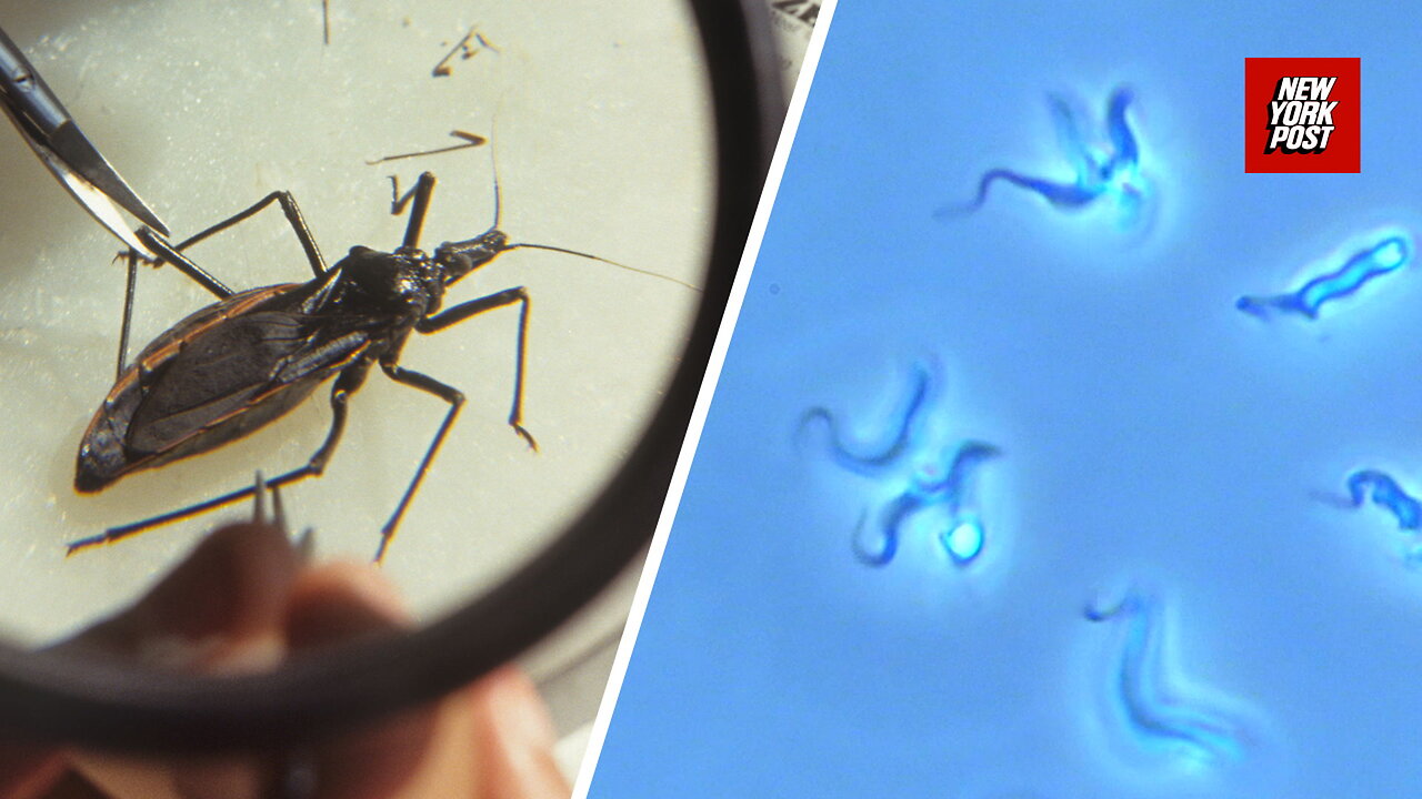 What is Chagas Disease? The Scary Truth About the Kissing Bug Parasite Spreading in the US