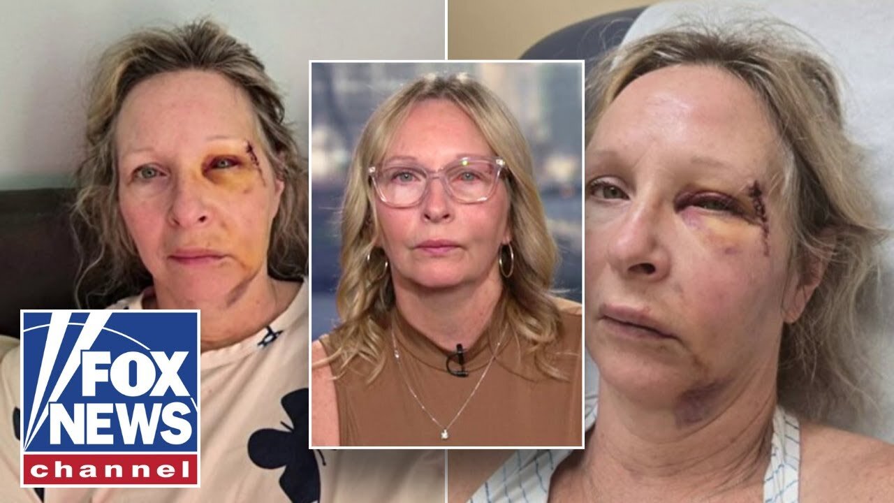 HE PUNCHED ME IN THE FACE: Crime victim details attack by suspect with 13 prior arrests