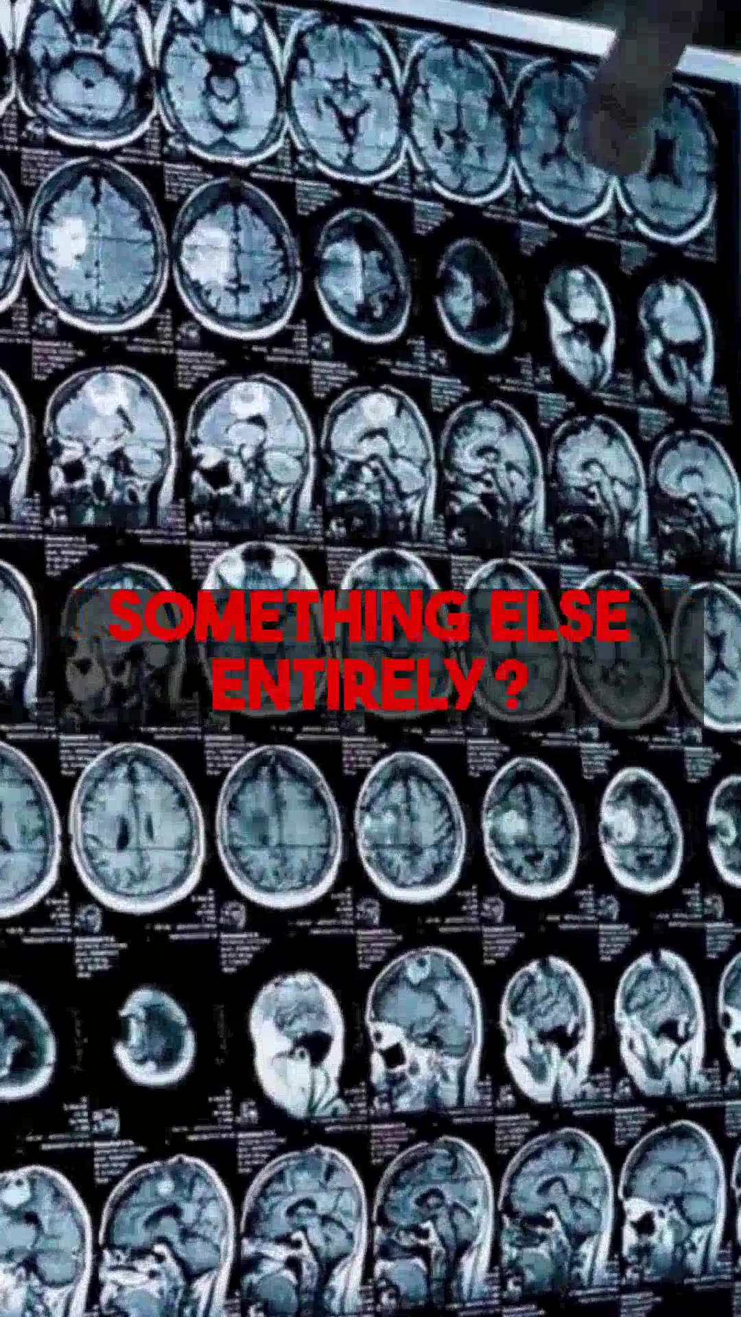 Unchanged Mass After Surgery Scan Should You Seek a Second Opinion