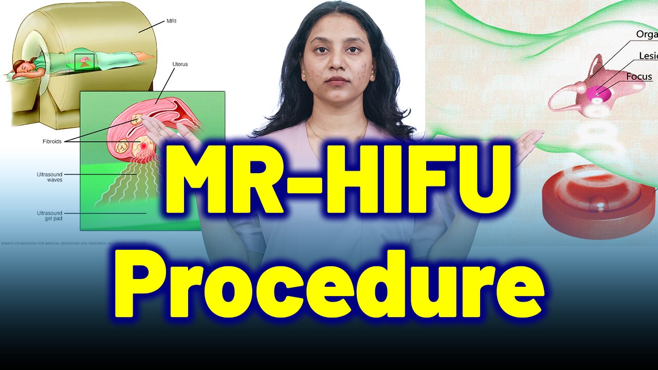 MR-HIFU Procedure: Non-Surgical Relief from Fibroids | Treatment Cure Medicine | Gynaecology Women
