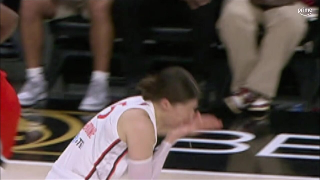 🫢 FLAGRANT, Melbourne LOSES TOOTH being ELBOWED by Chelsea Gray | WNBA womens basketball