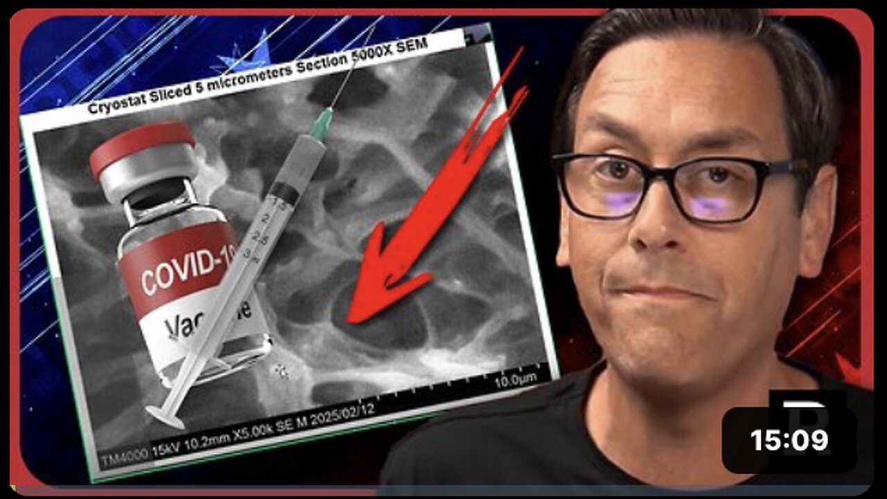 SHOCK! EMBALMERS FINDING WHITE FIBEROUS CLOTS IN BODIES Weve NEVER seen these before | Redacted