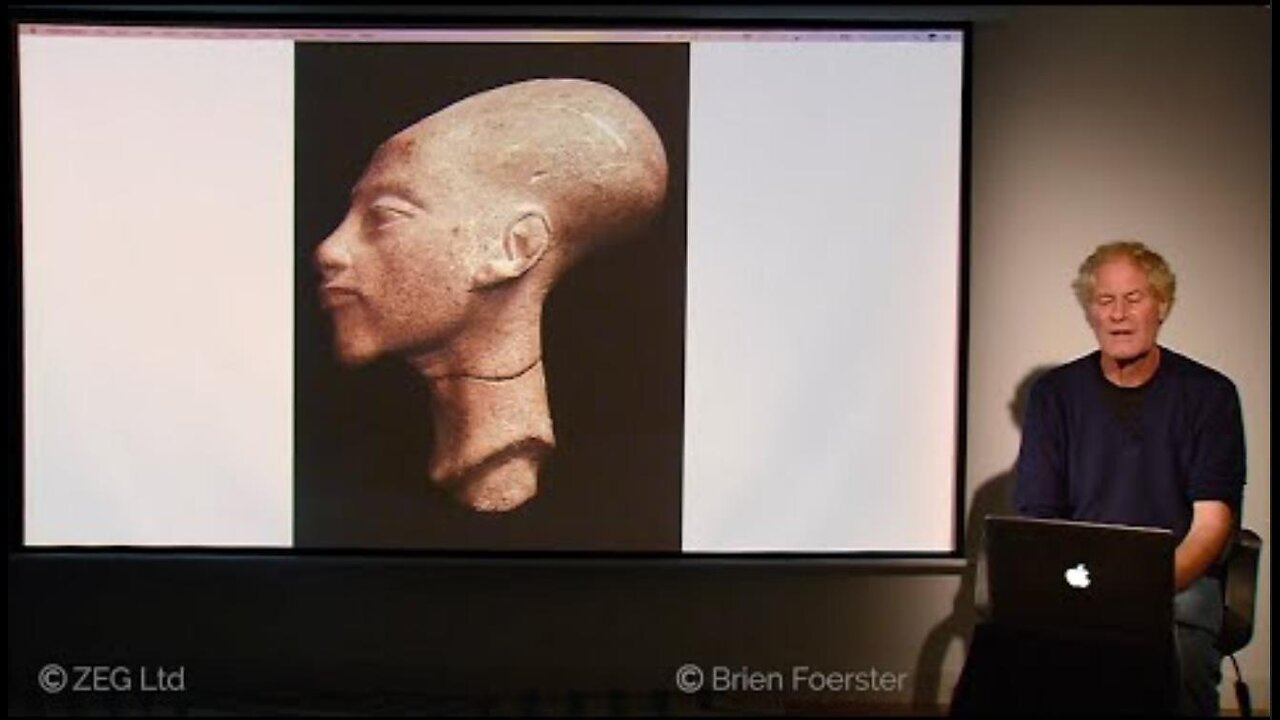 Elongated Skull Phenomenon: Global Presence, DNA Analysis, Blood Type Anomalies & More ~ By Author Brien Foerster (10.30.21) (10.30.21)