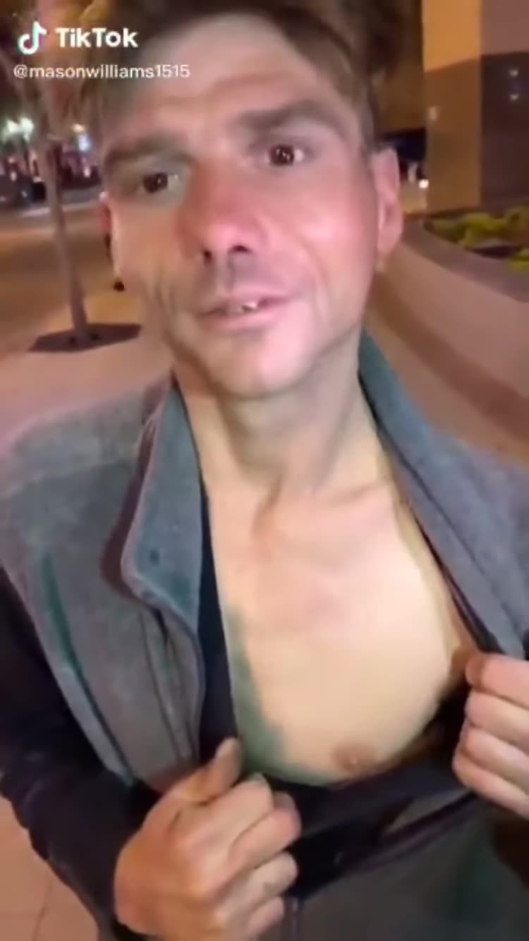 Mans Heart Jumps Out of His Chest