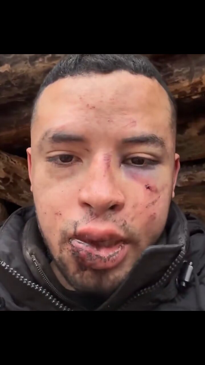Mercenario colombiano denuncia secuestro por el Ejército de Ucrania