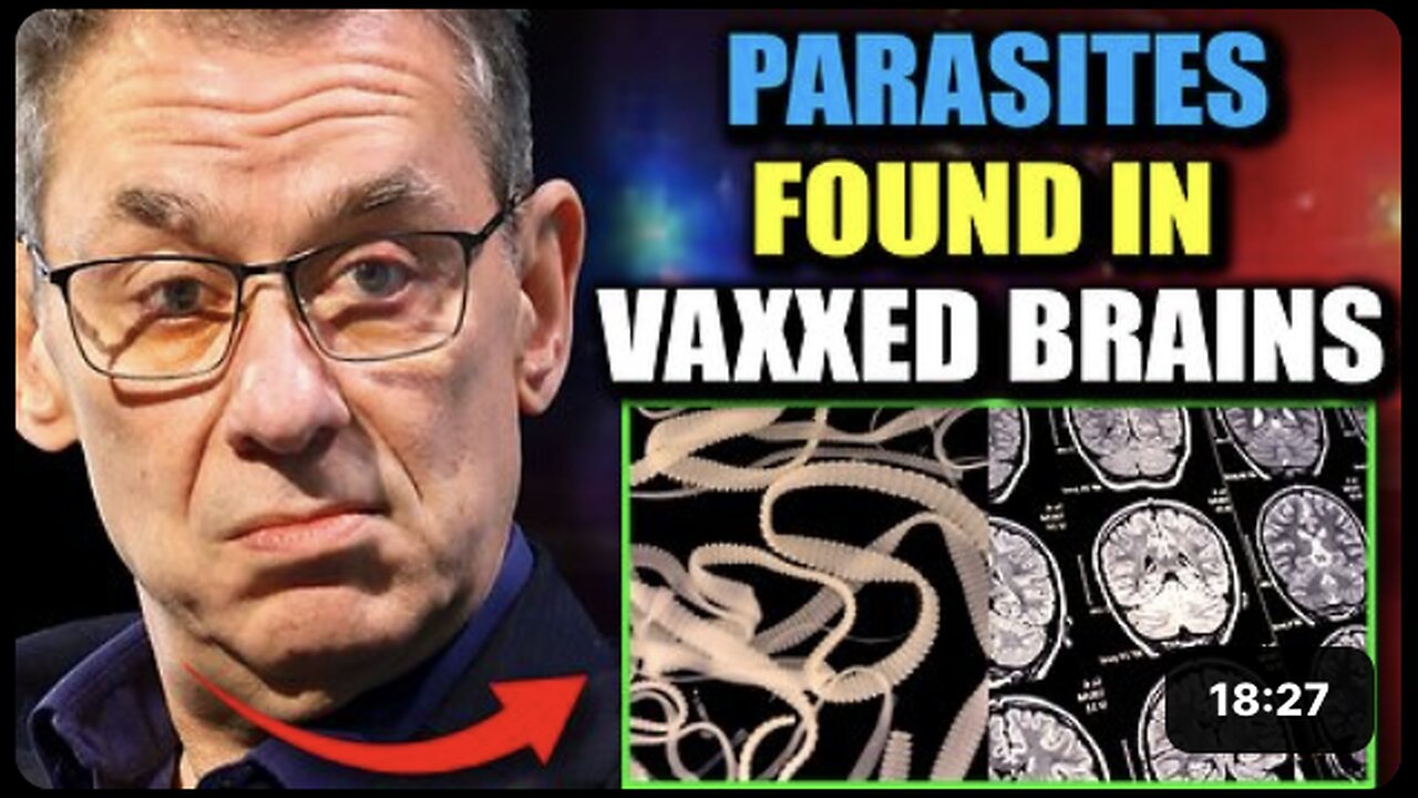 Scientists Discover Parasitic Entities in Brains of Jabbed - Media Blackout