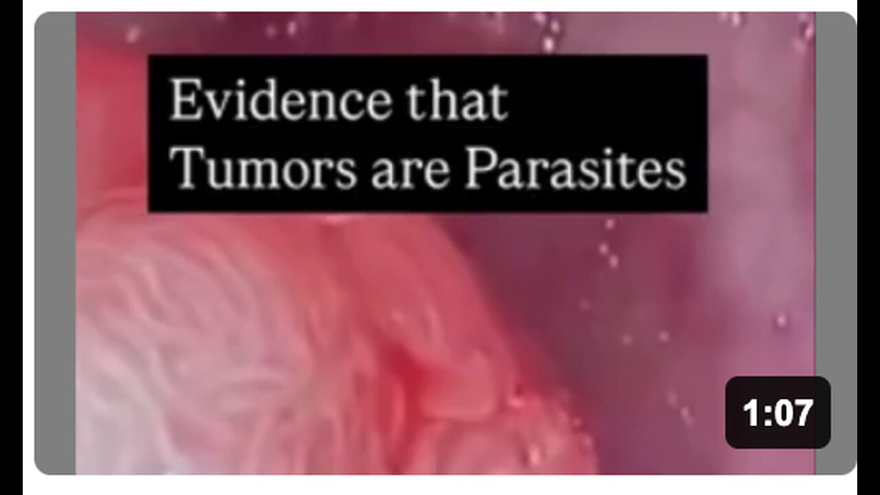Tumors are Parasites