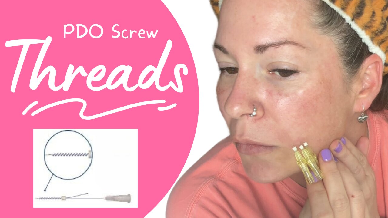 PDO screw threads