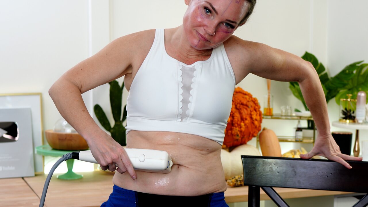 HIFU Body Treatment video