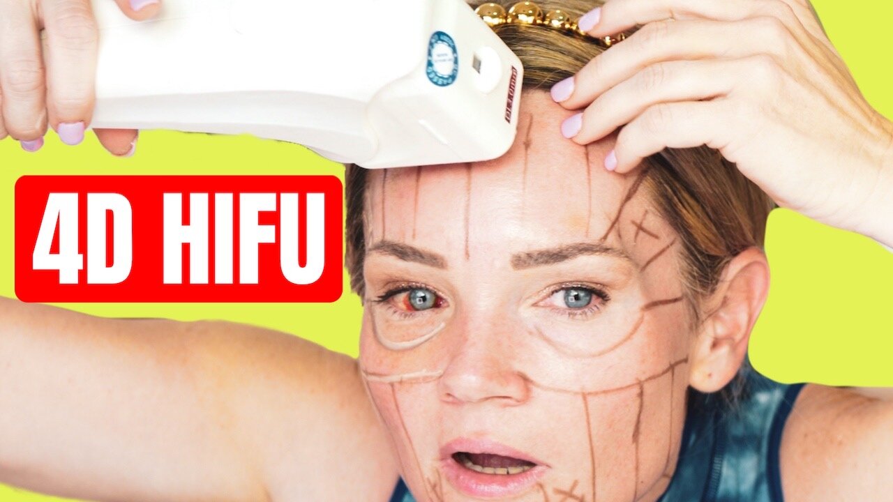 HIFU Part 1 video