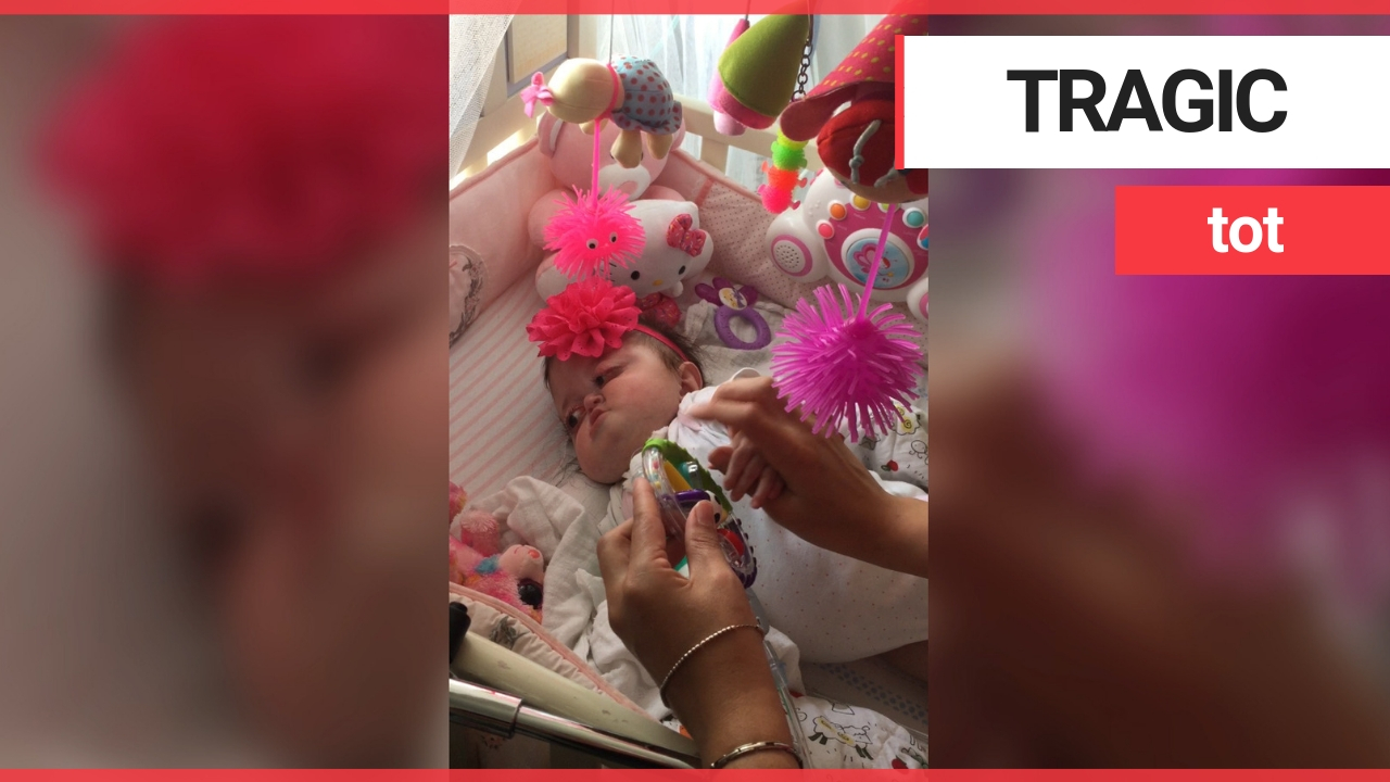 Severely disabled baby girl - called a monster by online trolls