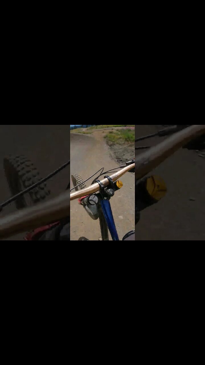I cant believe this massive jump line exists at a public bike park!