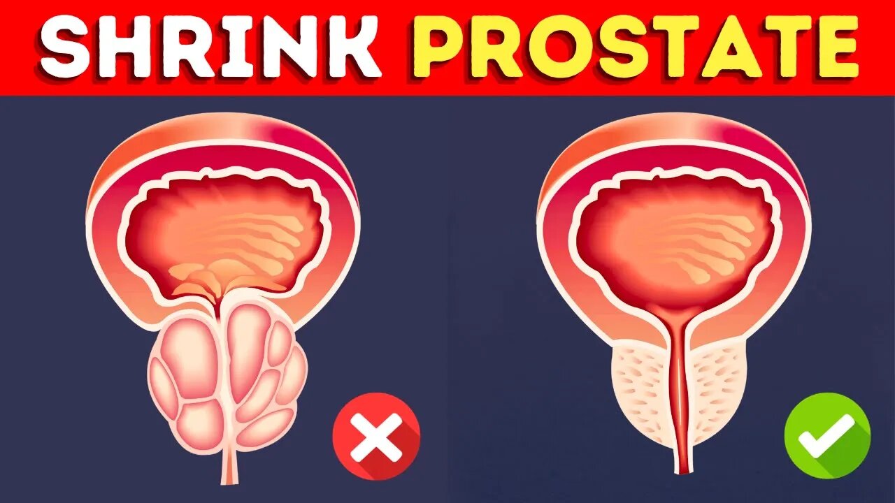 How to Shrink an Enlarged Prostate Fast and Naturally