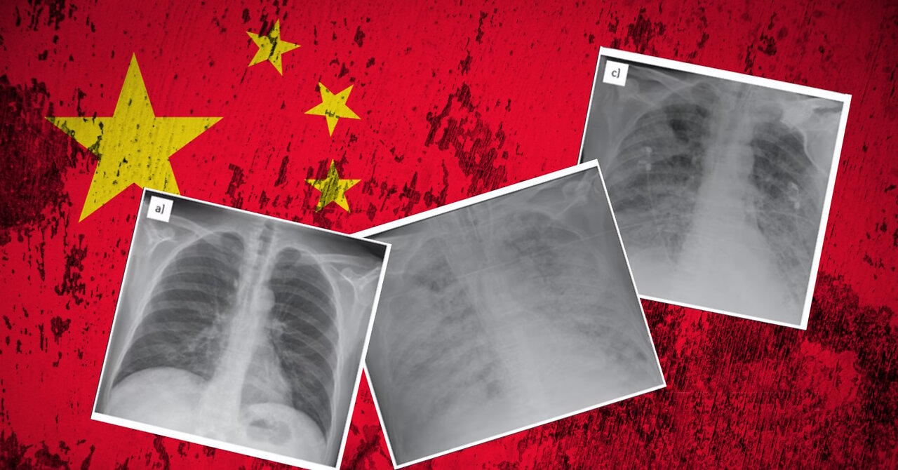 Dr. Lee Merritt: Exposing The Latest Chinese White Lung Narrative - Same Playbook As COVID
