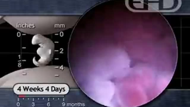 Unborn Baby's Heartbeat