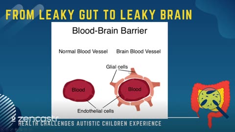 27 of 63 - From Leaky Gut to Leaky Brain - Health Challenges Autistic Children Experience