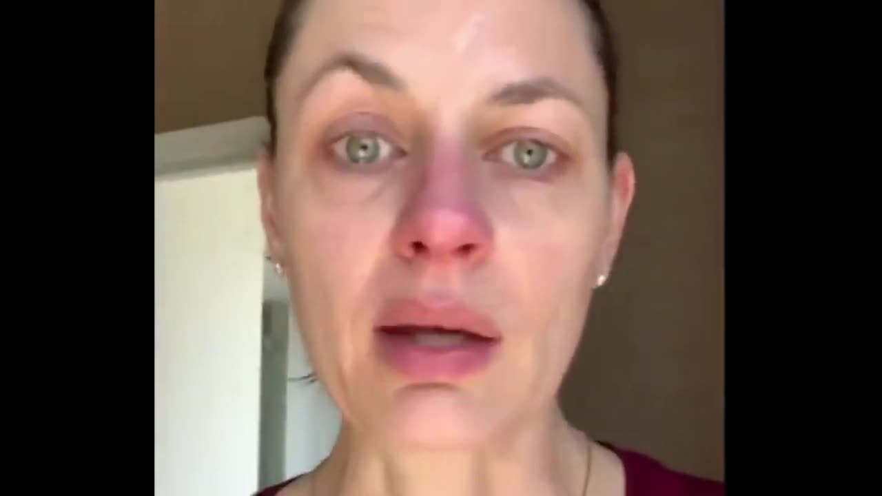Canadian Actress Gets Bells Palsy After Vaxxed, Would Do Again